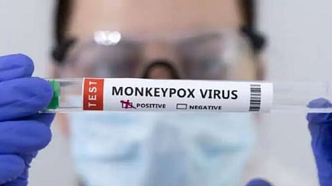 Monkeypox Update News (File Photo)