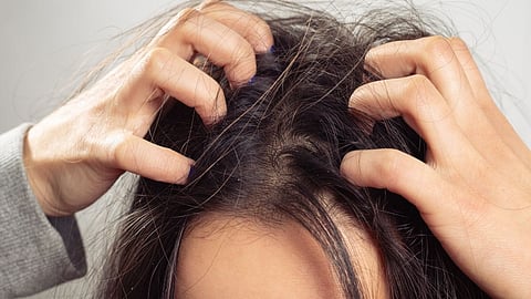 Hair care tips in Marathi, Hair care problem, hair falls problem, oily hair problems, 