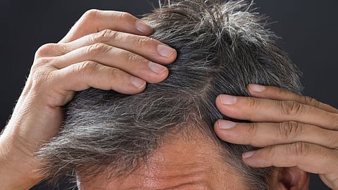 White hair problem, Hair care tips 