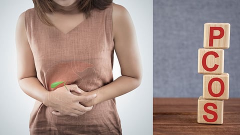 PCOS