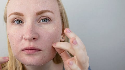 Itchy & Dry Skin