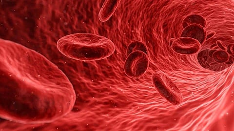 Hemoglobin Deficiency