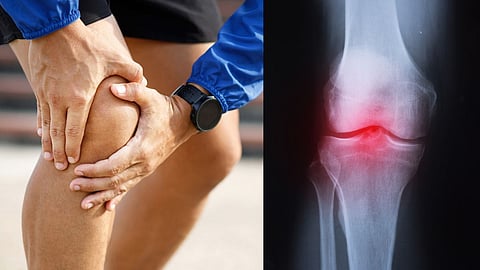 World Arthritis Day
