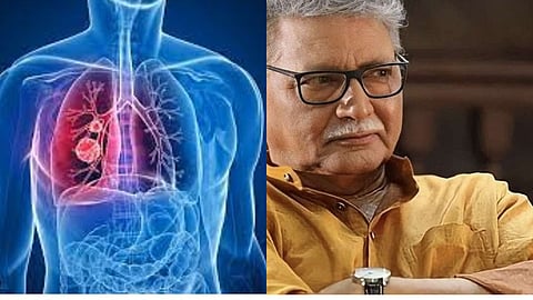 Multiple organ failure