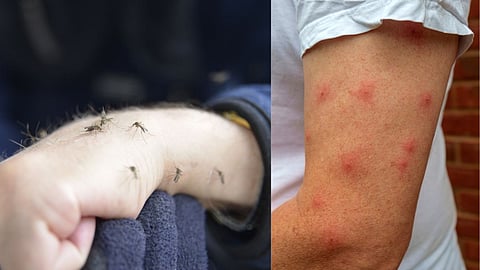 Mosquito Problem 