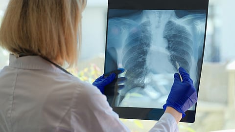 World COPD Day 