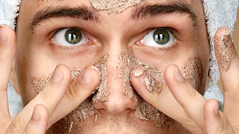 Acne Problem 