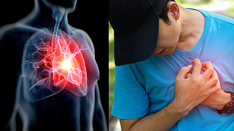 Heart Attack In Youth 