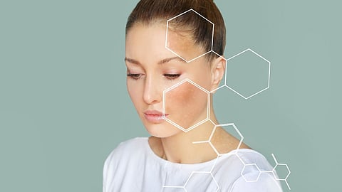 Dry Skin Remedies
