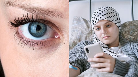 Cancer Symptoms 