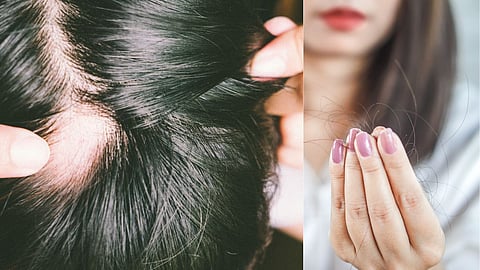 Hair Fall Reasons