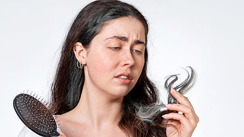 Hair Loss Causes