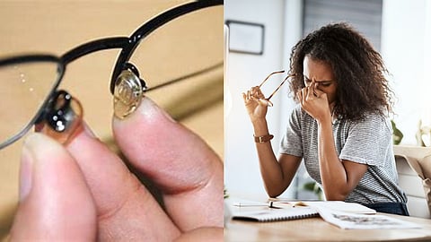 Eye Glasses Marks On Nose 