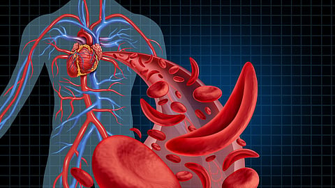 Hemoglobin Decrease