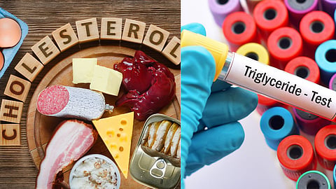 Cholesterol And Triglycerides 