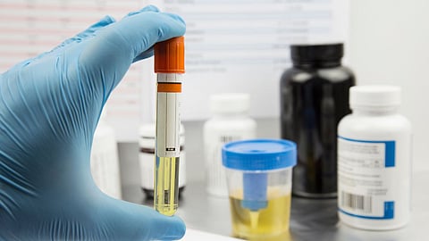 Urine Disease