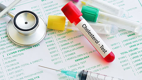 Cholesterol Level Control