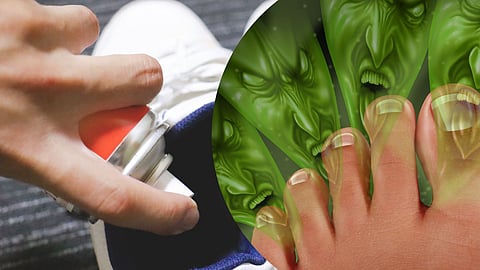 Foot Odor Problem 