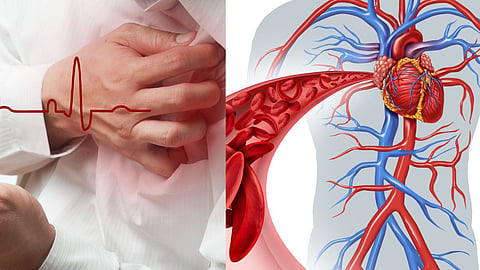 Heart Block