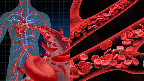 Hemoglobin Deficiency 