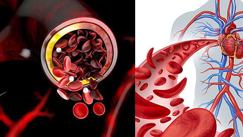 Food To Increase Hemoglobin
