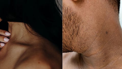 Dark Neck Home Remedies