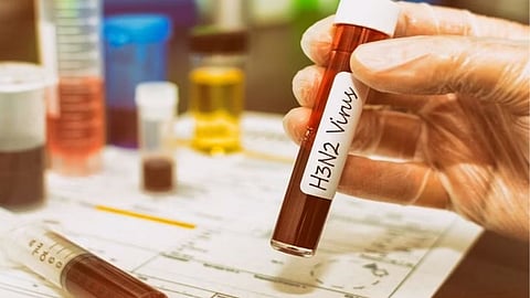 Influenza In Maharashtra 