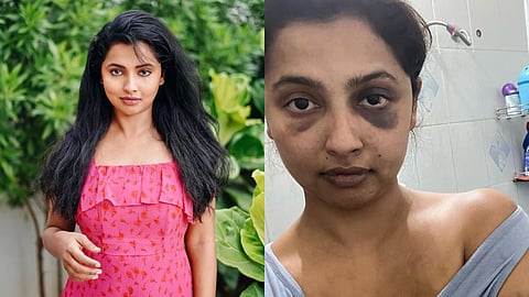 Anicka Vikhraman Photo
