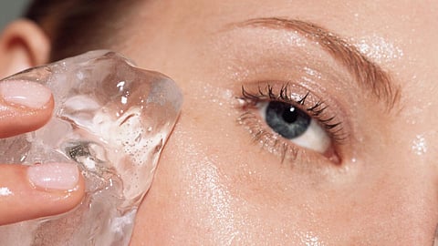 Ice On Pimples