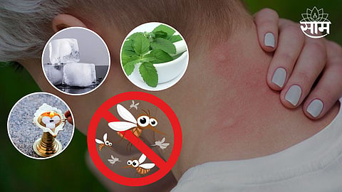 Skin Care After Mosquito Bites