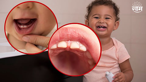 Baby Teething 