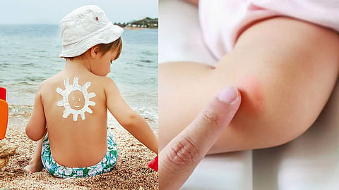 Summer Baby Care