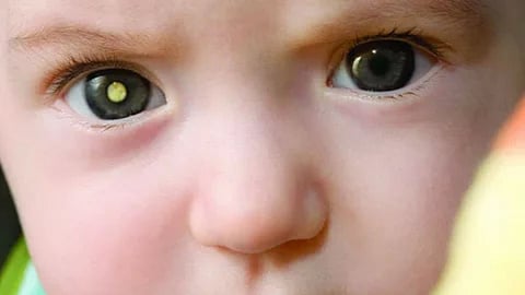 Child Eye Care 