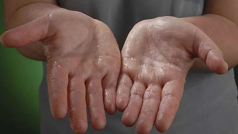 Sweaty Palms 