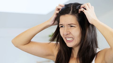 Dandruff Removal