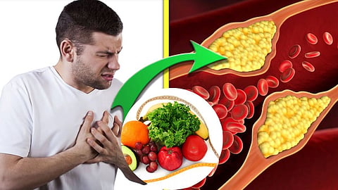 High Cholesterol Food