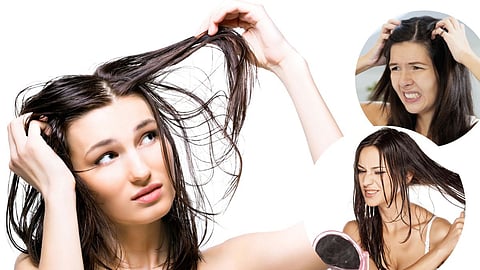 Oily Hair Home Remedies
