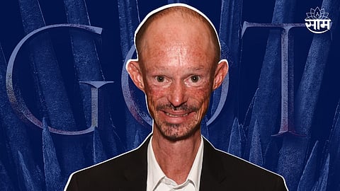 Game Of Thrones Fame Darren Kent Passes Away