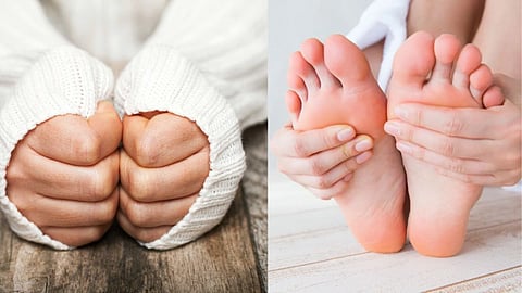Iron Deficiency