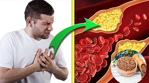 Bad Cholesterol