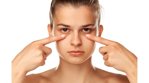 Dark Circles 