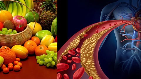 High Cholesterol Food