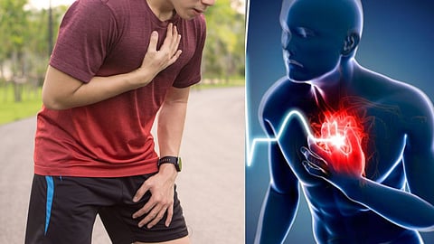 Heart Attack Symptoms In Players