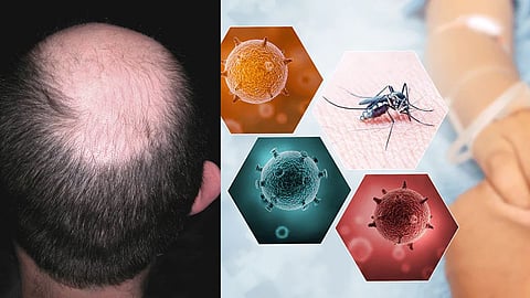 Dengue Symptoms