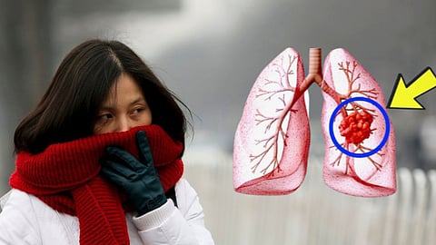Air Pollution