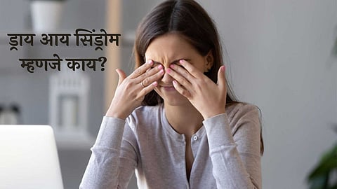 Dry Eye Syndrome 