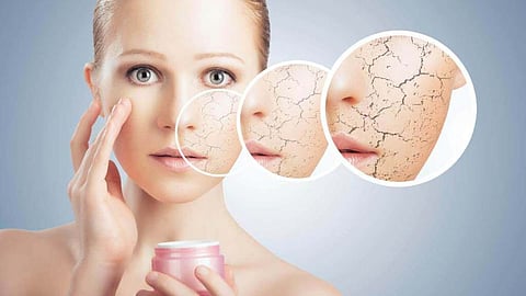 Winter Skin Care