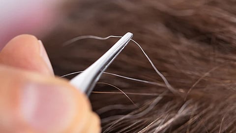 White Hair Care