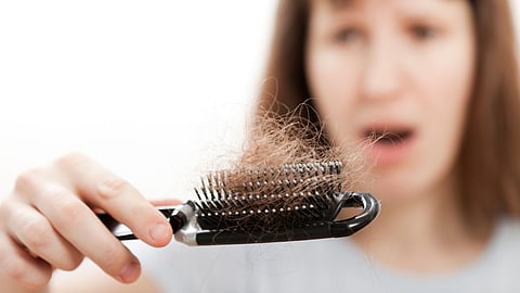Hair Loss Causes