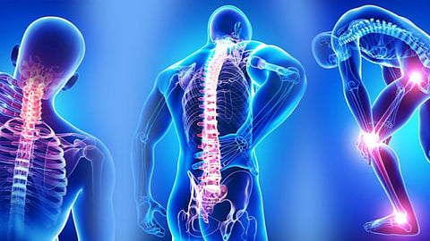 Bad Foods For Bones